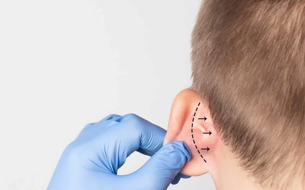 Kulak Estetiği Kaç Yaşında Yapılır?