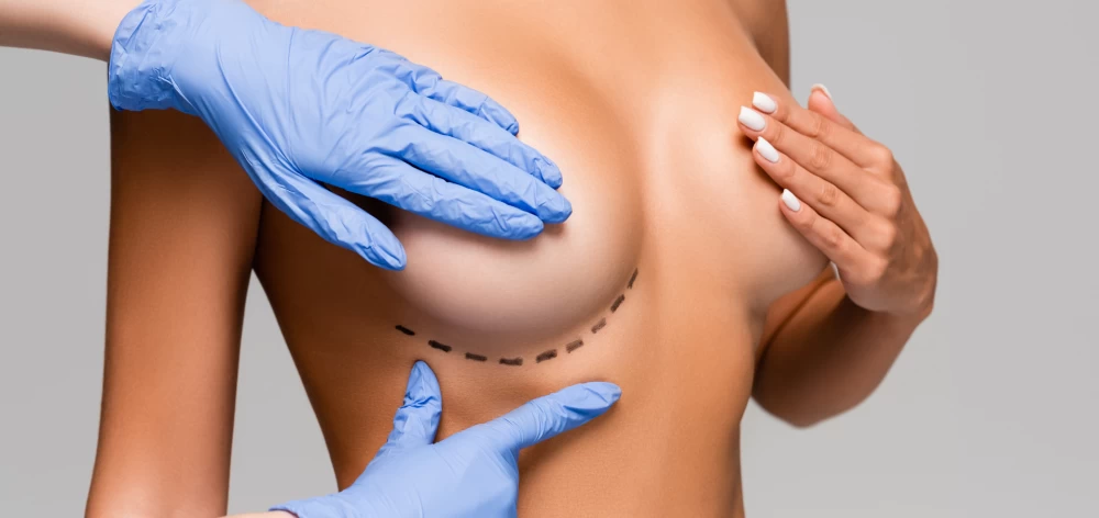 Nipple Reconstruction for Inverted Nipples